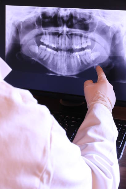 Best Emergency Tooth Extraction in Monument, CO